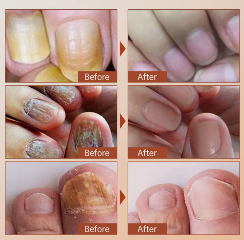 Suero Reparador y fortalecedor de Uñas - Nails Repairing + ENVIO GRATIS