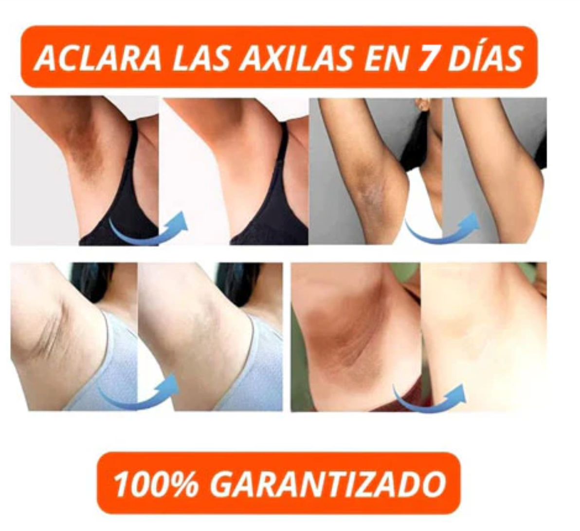 CREMA ACLARADORA 2X1 ¡DILE ADIOS A LAS MANCHAS Y LUCE UNA PIEL RADIANTE! + ENVIO GRATIS