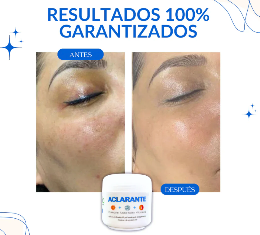 CREMA ACLARADORA 2X1 ¡DILE ADIOS A LAS MANCHAS Y LUCE UNA PIEL RADIANTE! + ENVIO GRATIS