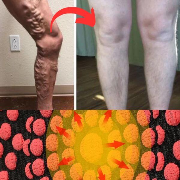 Calcetines de Acupresión Compress® Anti-Varices + Envio Gratis