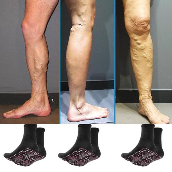 Calcetines de Acupresión Compress® Anti-Varices + Envio Gratis