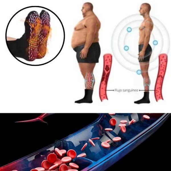 Calcetines de Acupresión Compress® Anti-Varices + Envio Gratis