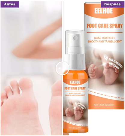 ByeCallus - Spray Exfoliante para el Cuidado de los pies - Dile Adiós a los Callos + Envio Gratis