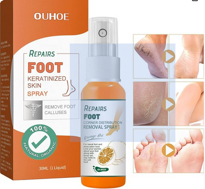 ByeCallus - Spray Exfoliante para el Cuidado de los pies - Dile Adiós a los Callos + Envio Gratis