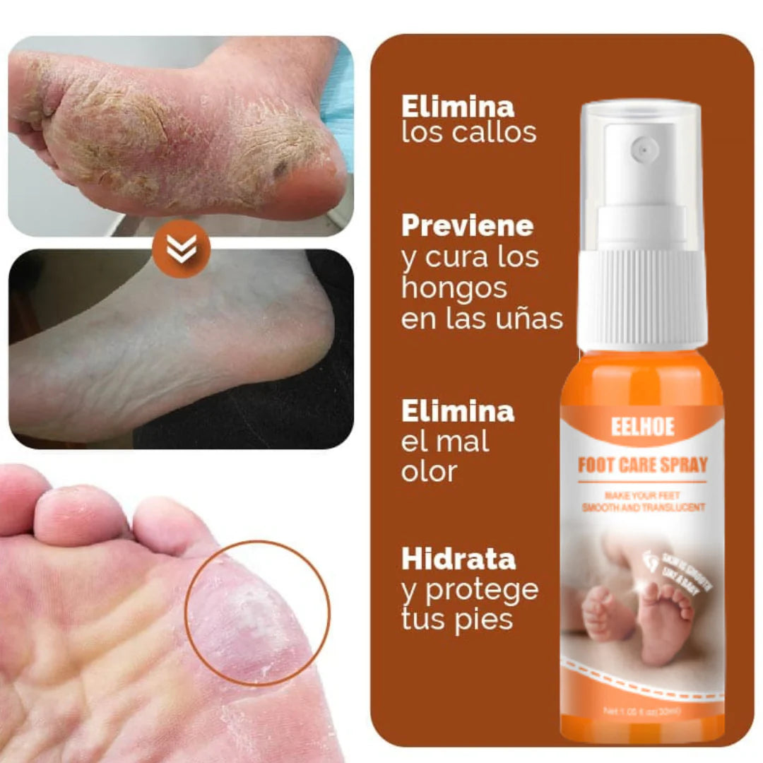 ByeCallus - Spray Exfoliante para el Cuidado de los pies - Dile Adiós a los Callos + Envio Gratis